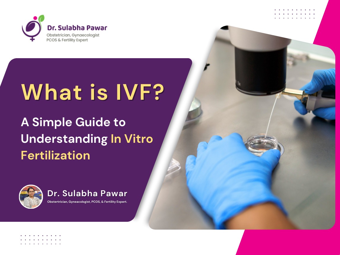 what is IVF